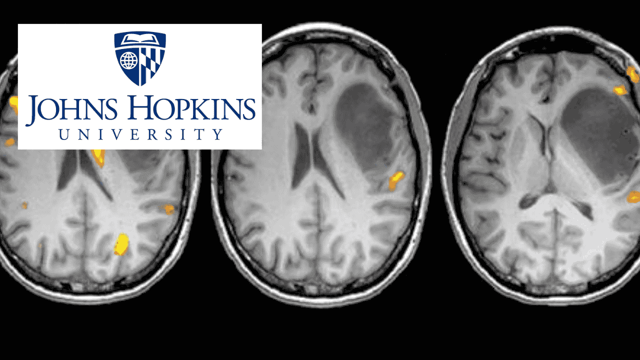 Principles of fMRI 1
