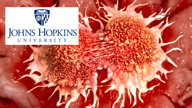 Understanding Cancer Metastasis