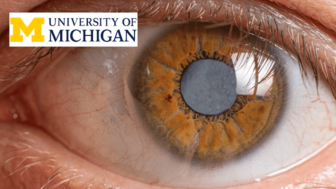 Cataract Surgery Training: Comprehensive Introduction