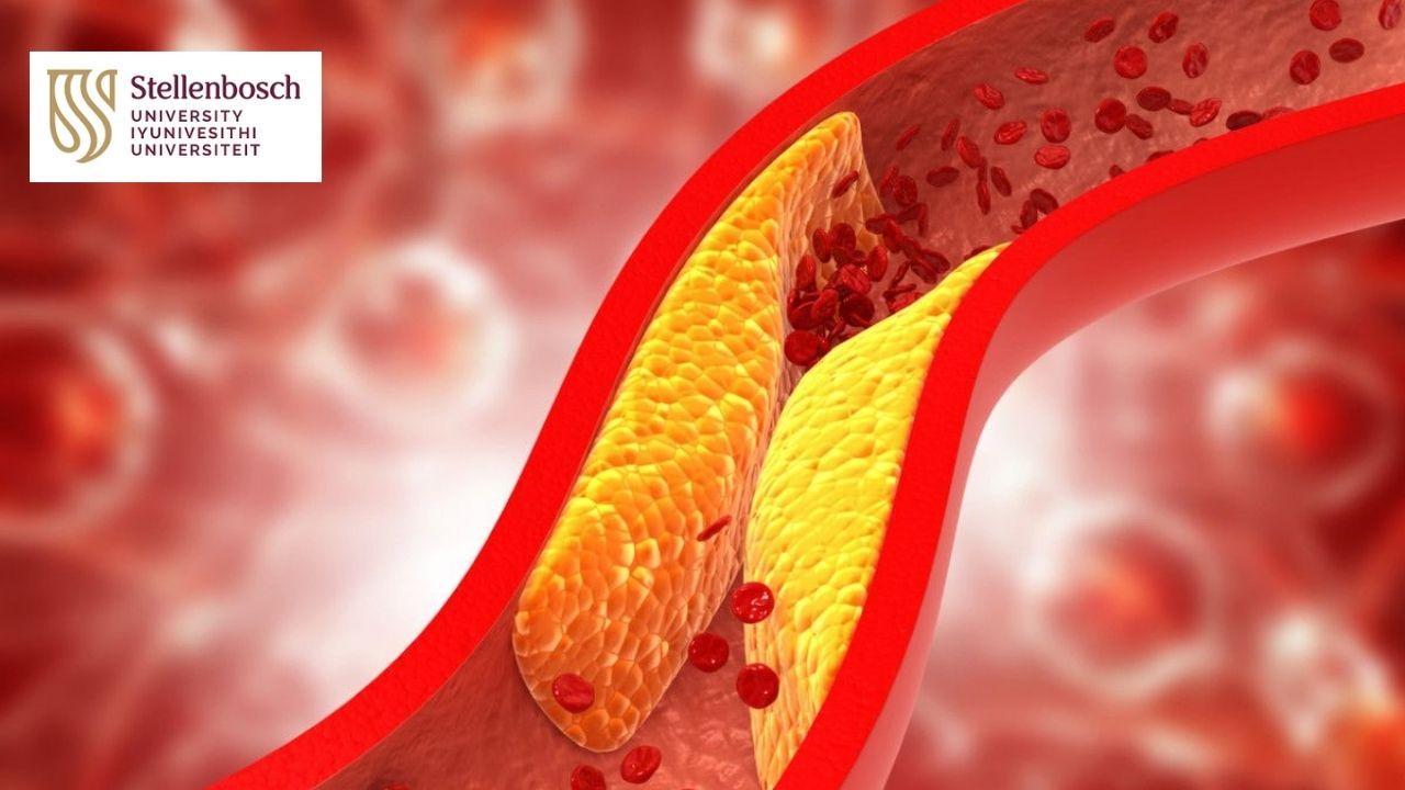 Managing Coronary Artery Disease