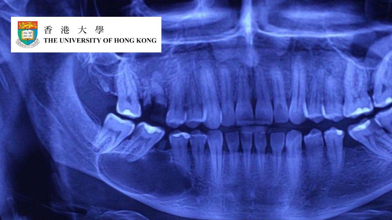 Dento-Maxillofacial Radiology in Dental Medicine